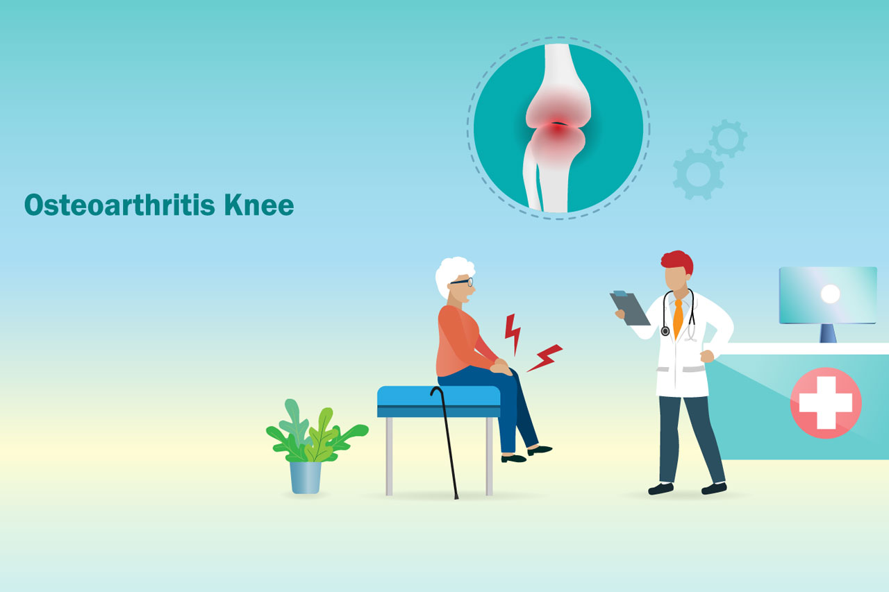 Knee Joint Deterioration